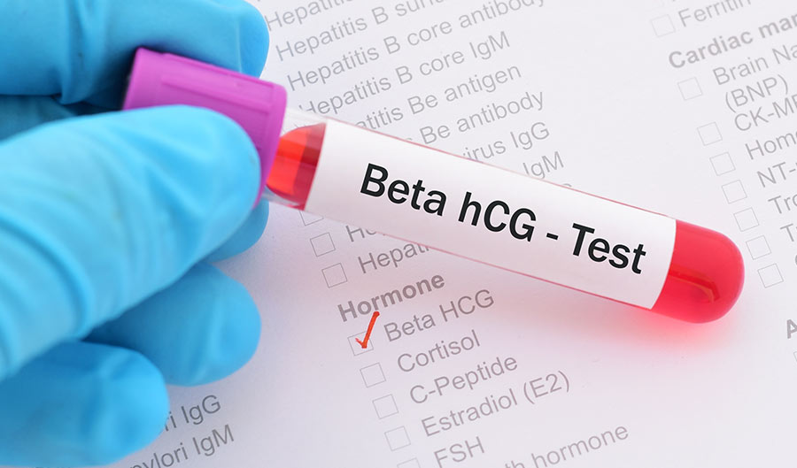 What is beta HCG test