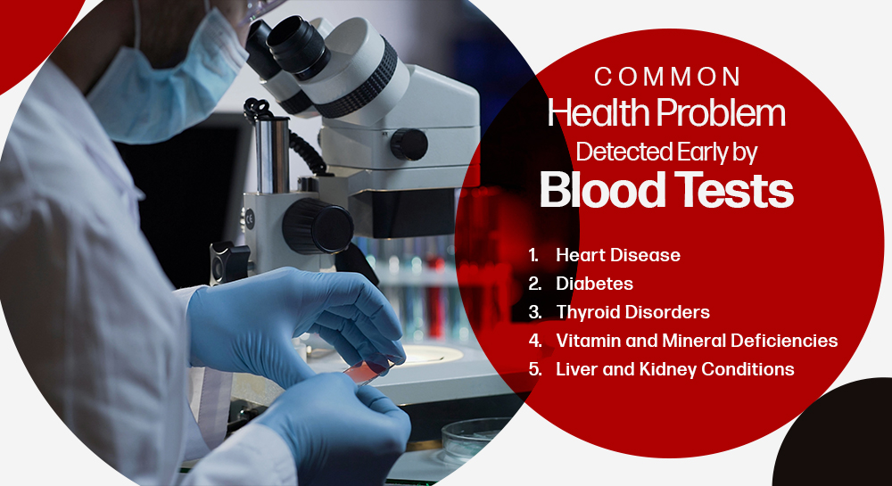 Common Health Problems Detected Early by Blood Tests