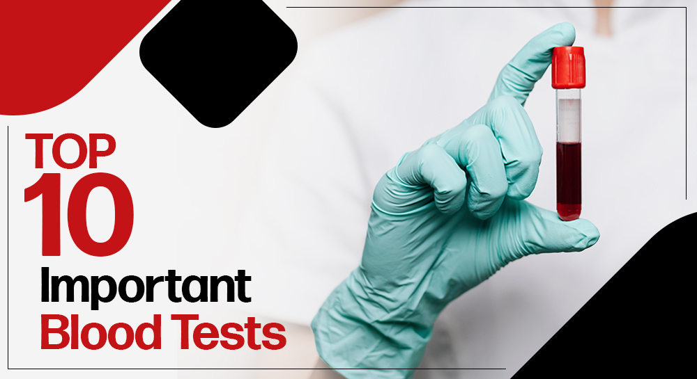 Top 10 Important Blood Tests