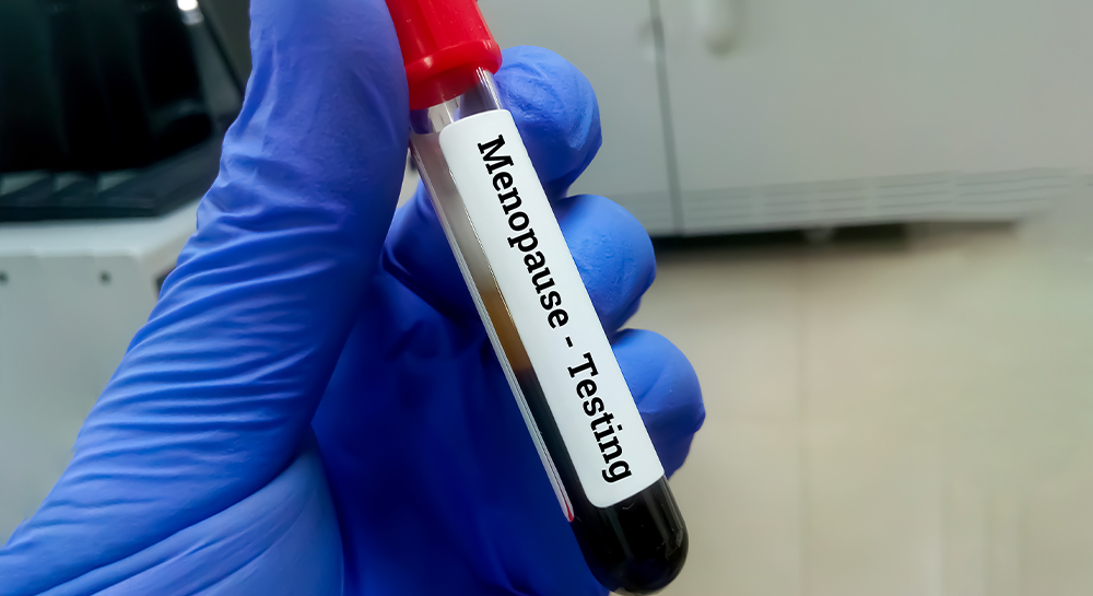 Menopause and Hormones: What a Blood Test Can Tell You About the Change